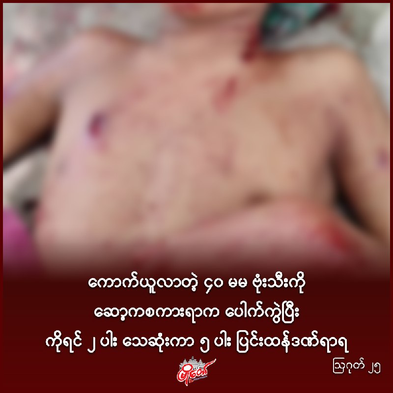 ကောက်ယူလာတဲ့ ၄၀ မမ ဗုံးသီးကို ဆော့ကစကားရာက ပေါက်ကွဲပြီး ကိုရင် ၂ ပါး သေဆုံးကာ ၅ ပါး ပြင်းထန်ဒဏ်ရာရ