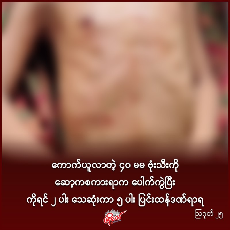 ကောက်ယူလာတဲ့ ၄၀ မမ ဗုံးသီးကို ဆော့ကစကားရာက ပေါက်ကွဲပြီး ကိုရင် ၂ ပါး သေဆုံးကာ ၅ ပါး ပြင်းထန်ဒဏ်ရာရ