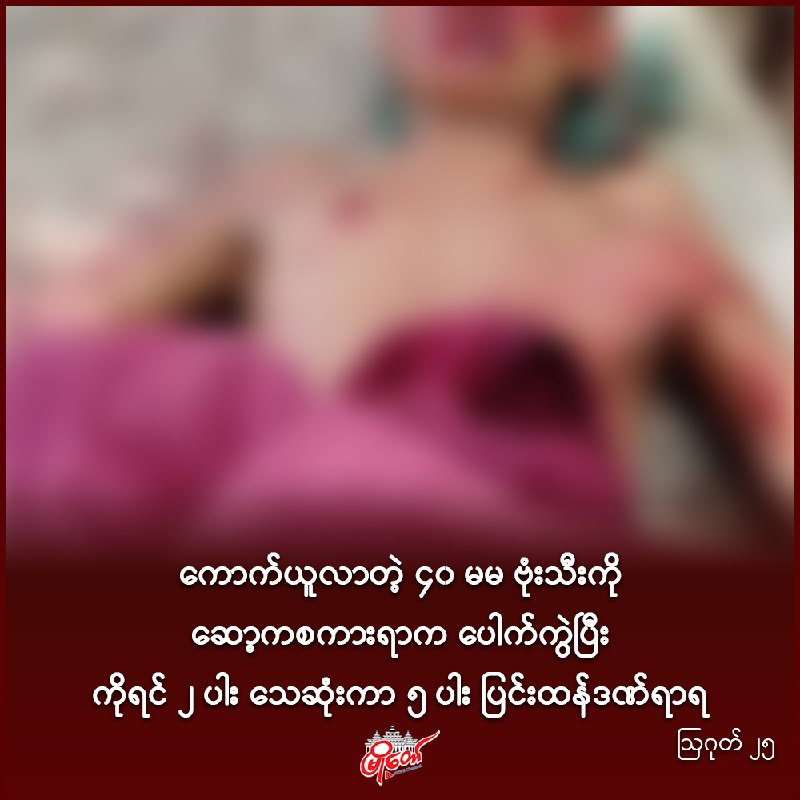 ကောက်ယူလာတဲ့ ၄၀ မမ ဗုံးသီးကို ဆော့ကစကားရာက ပေါက်ကွဲပြီး ကိုရင် ၂ ပါး သေဆုံးကာ ၅ ပါး ပြင်းထန်ဒဏ်ရာရ