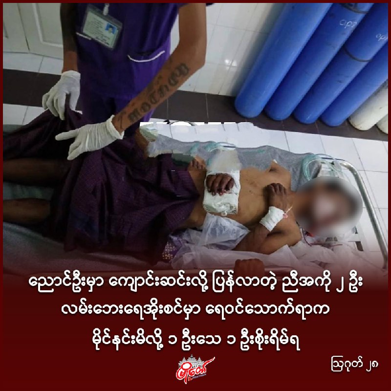ညောင်ဦးမှာ ကျောင်းဆင်းလို့ ပြန်လာတဲ့ ညီအကို ၂ ဦး လမ်းဘေးရေအိုးစင်မှာ ရေဝင်သောက်ရာက မိုင်နင်းမိလို့ ၁ ဦးသေ ၁ ဦးစိုးရိမ်ရ