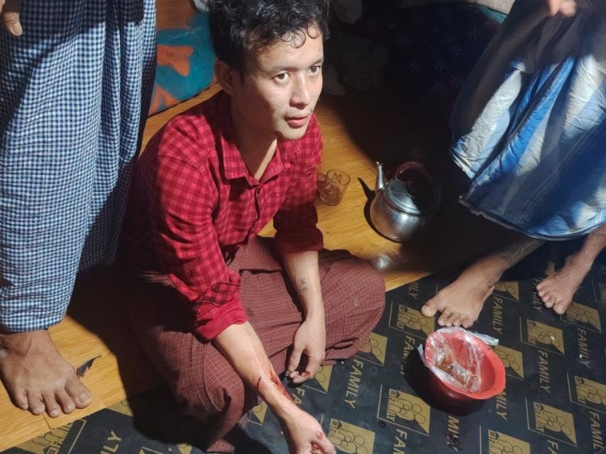 兄弟俩吃饭时因猫争吵持刀相向 哥哥身亡