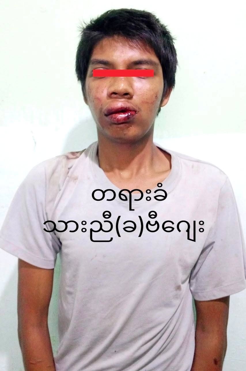 အသက် ၄ နှစ်အရွယ် ကလေးငယ်ကို လိင်ပိုင်းဆိုင်ရာ ပြုကျင့်ဖို့ ကြံရွယ်ခဲ့သူကို ဖမ်းဆီးအမှုဖွင့်