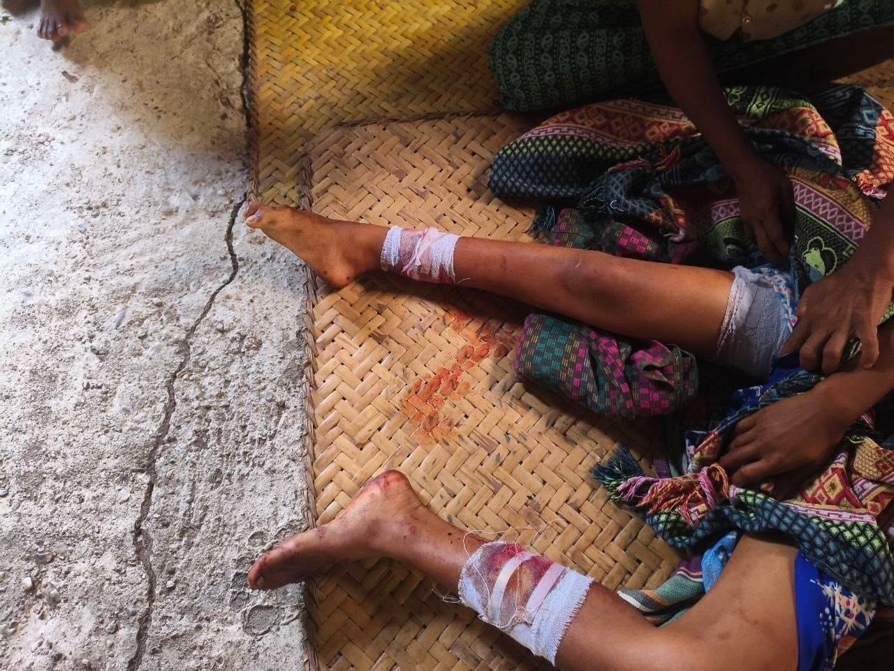 ကပစ ၁၂ မှ တက်လာတဲ့ ပါရာမော်တာ ၃ စီးက တိုက်ခိုက်ခဲ့လို့ အသက်မပြည့်သေးတဲ့ ကလေးငယ်အပါအဝင် ၂ ဦး သေဆုံးခဲ့ပြီး ၃ ဦးဒဏ်ရာရ