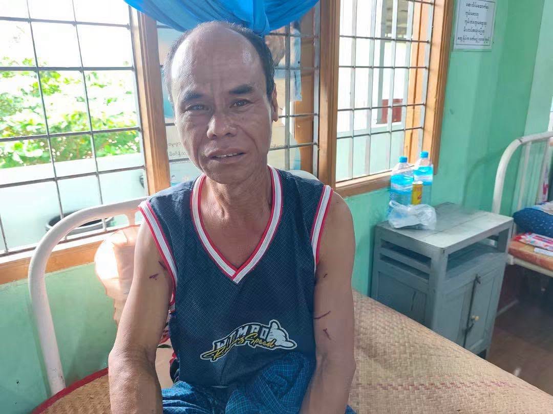 နေအိမ်အနီး မိုးကြိုးပစ်ရာက စက်ကွင်းထိပြီး သားအဖ ၂ ဦး ထိခိုက်ဒဏ်ရာရ